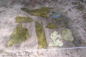 2,6 kg de plastique ont été retiré du cloaque d'une tortue luth femelle © Virginie Plot